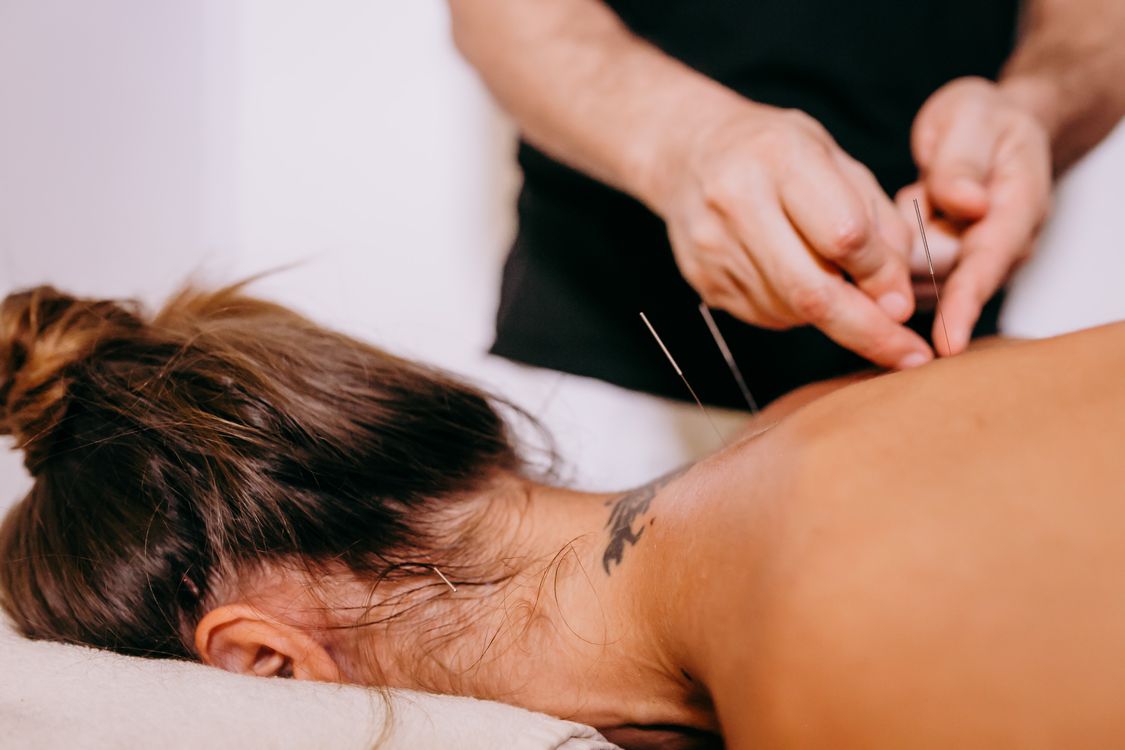 Practitioner inserting acupuncture needles along the patient's back